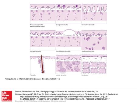 Nine patterns of inflammatory skin disease. (See also Table 8–1.)