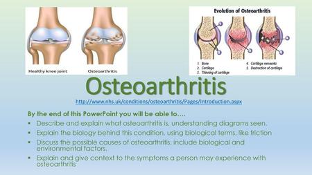 Osteoarthritis By the end of this PowerPoint you will be able to….