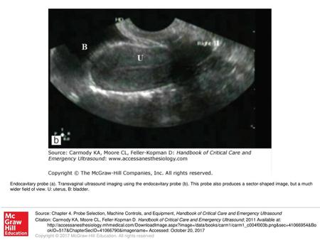 Endocavitary probe (a)