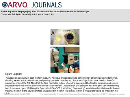 Trans. Vis. Sci. Tech ;5(6):5. doi: /tvst.5.6.5 Figure Legend: