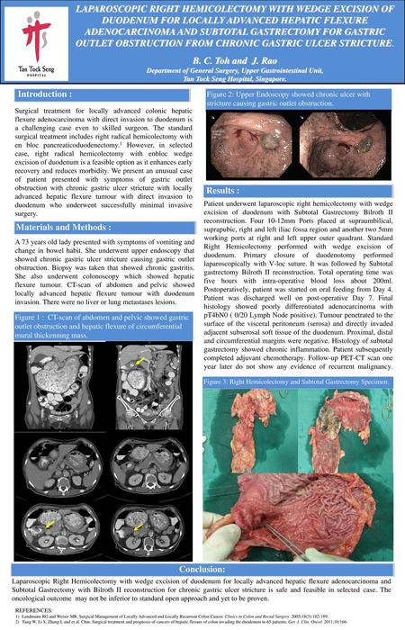 Department of General Surgery, Upper Gastrointestinal Unit,