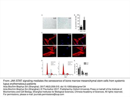 Figure 1. BM-MSCs from SLE patients showed senescence characteristics (A,B) SA-β-gal was used to examine BM-MSC senescence. The number of SA-β-gal-positive.