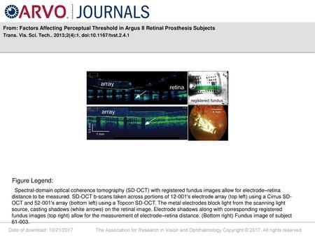 Trans. Vis. Sci. Tech ;2(4):1. doi: /tvst.2.4.1 Figure Legend: