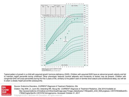 Typical pattern of growth in a child with acquired growth hormone deficiency (GHD). Children with acquired GHD have an abnormal growth velocity and fail.