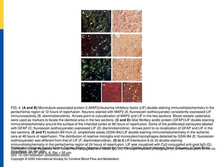 FIG. 4. (A and B) Microtubule-associated protein-2 (MAP2)/leukemia inhibitory factor (LIF) double-staining immunohistochemistry in the periischemia region.