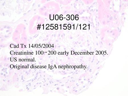 U # /121 Cad Tx 14/05/2004 Creatinine early December 2005. US normal.