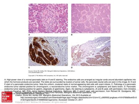 A. High-power view of a normal pancreatic islet on H and E staining