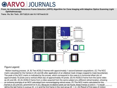 From: An Automated Reference Frame Selection (ARFS) Algorithm for Cone Imaging with Adaptive Optics Scanning Light Ophthalmoscopy Trans. Vis. Sci. Tech..