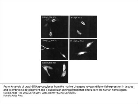 Figure 8. Subcellular localisation of murine and human nuclear forms in fusion with EGFP in NIH 3T3 and HeLa cells. Ung2EGFP in NIH 3T3 (A) and HeLa (B)