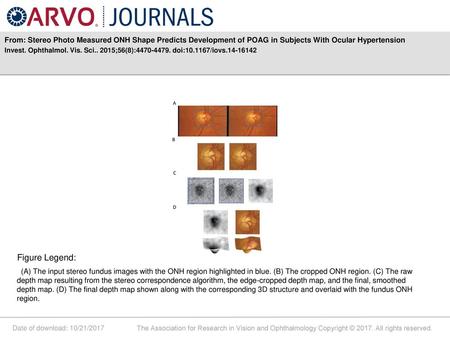 From: Stereo Photo Measured ONH Shape Predicts Development of POAG in Subjects With Ocular Hypertension Invest. Ophthalmol. Vis. Sci.. 2015;56(8):4470-4479.