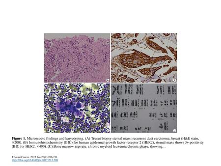 Figure 1. Microscopic findings and karyotyping