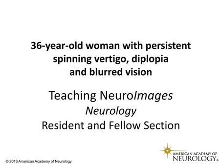 36-year-old woman with persistent spinning vertigo, diplopia