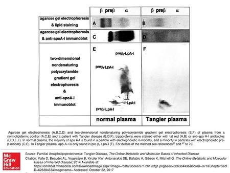 Agarose gel electrophoresis (A,B,C,D) and two-dimensional nondenaturing polyacrylamide gradient gel electrophoresis (E,F) of plasma from a normolipidemic.