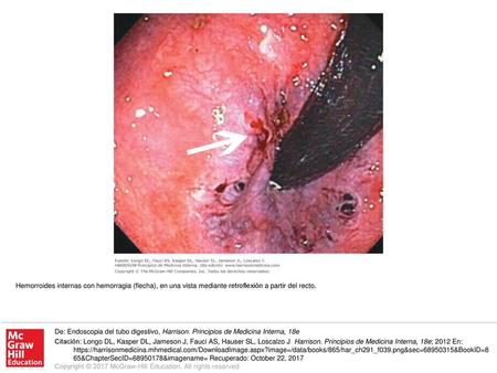 De: Endoscopia del tubo digestivo, Harrison