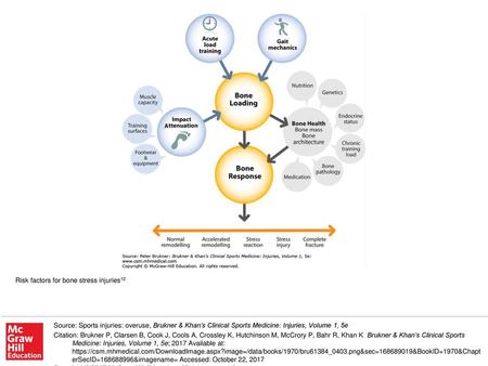 Risk factors for bone stress injuries12