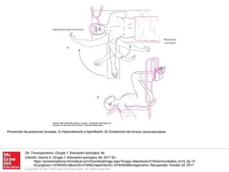 Prevención de posiciones forzadas. A) Hiperextensión e hiperflexión