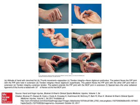 (a) Attitude of hand with clenched fist (b) Thumb movement—opposition (c) Tendon integrity—flexor digitorum profundus. The patient flexes the DIP joint.