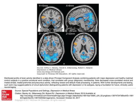 Distributed profile of brain activity identified in a data-driven Principal Component Analysis combining patients with major depression and healthy matched.