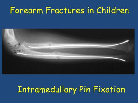 Forearm Fractures in Children