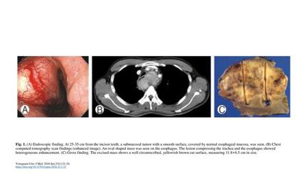 Fig. 1. (A) Endoscopic finding