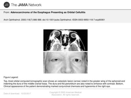 Copyright © 2000 American Medical Association. All rights reserved.