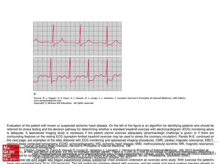 E. Stress and rest myocardial perfusion PET images obtained with rubidium-82 in a patient with chest pain on exertion. The images demonstrate a large and.