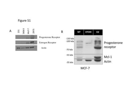 Progesterone receptor