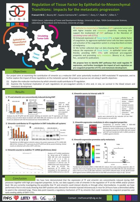 Epithelial-to-Mesenchymal Transitions Circulating Tumor Cells