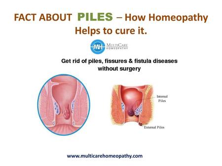 FACT ABOUT PILES – How Homeopathy Helps to cure it.