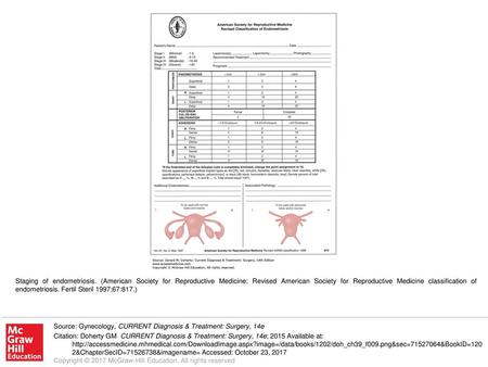 Staging of endometriosis