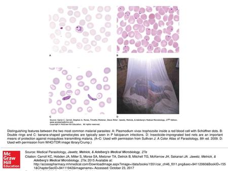 Distinguishing features between the two most common malarial parasites: A: Plasmodium vivax trophozoite inside a red blood cell with Schüffner dots. B: