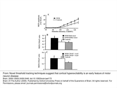 Fig. 1 Stimulus-response (SR) curves obtained following transcranial magnetic stimulation (TMS) stimulation in 19 MND patients and 34 normal controls,