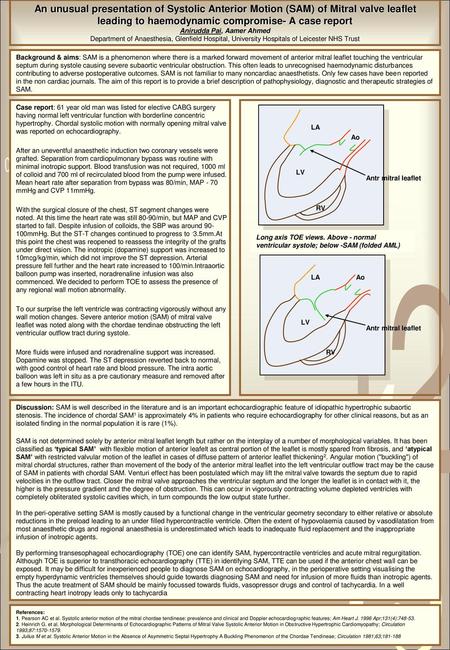 An unusual presentation of Systolic Anterior Motion (SAM) of Mitral valve leaflet leading to haemodynamic compromise- A case report Anirudda Pai, Aamer.