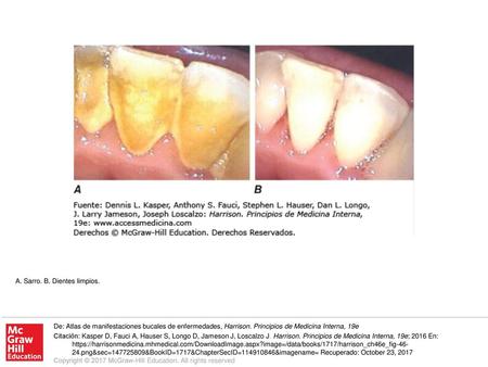 A. Sarro. B. Dientes limpios.