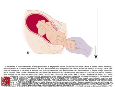 The movements of normal delivery for a vertex presentation. A