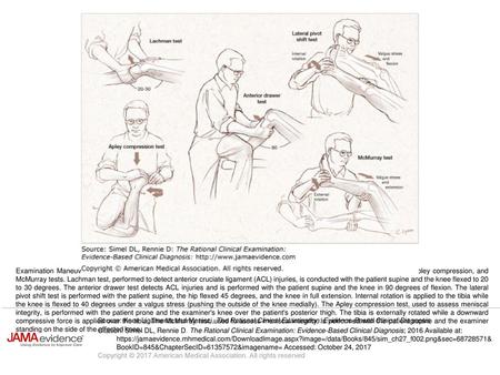 Examination Maneuvers Right knee shown