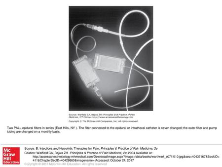 Two PALL epidural filters in series (East Hills, NY )