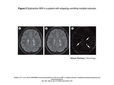 Nat. Rev. Neurol. doi: /nrneurol