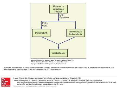 Schematic representation of the hypothesized pathway between maternal or intrauterine infection and preterm birth or periventricular leukomalacia. Both.