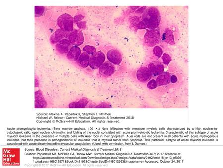 Acute promyelocytic leukemia. (Bone marrow aspirate, 100 ×