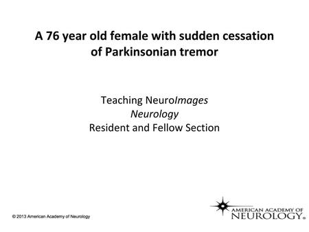 A 76 year old female with sudden cessation of Parkinsonian tremor