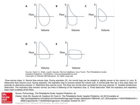 Flow–volume loops. A. Normal flow–volume loop