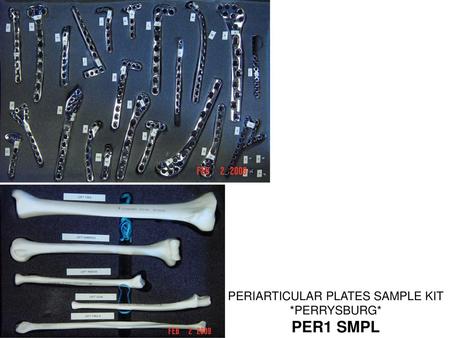 PERIARTICULAR PLATES SAMPLE KIT *PERRYSBURG*