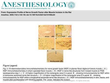 Anesthes. 2009;110(1): doi: /ALN.0b013e318190bc84 Figure Legend: