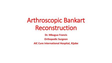 Arthroscopic Bankart Reconstruction