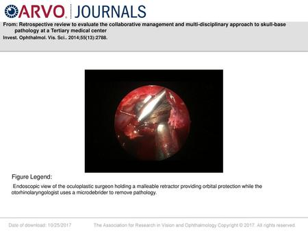 From: Retrospective review to evaluate the collaborative management and multi-disciplinary approach to skull-base pathology at a Tertiary medical center.