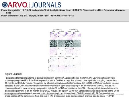 From: Upregulation of EphB2 and ephrin-B2 at the Optic Nerve Head of DBA/2J Glaucomatous Mice Coincides with Axon Loss Invest. Ophthalmol. Vis. Sci.. 2007;48(12):5567-5581.