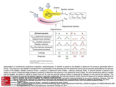 Source: Chapter 23. Urinary Incontinence, Williams Gynecology, 2e