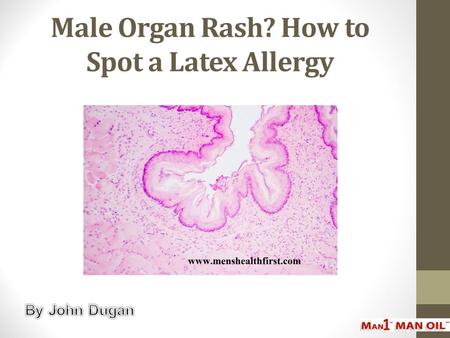 Male Organ Rash? How to Spot a Latex Allergy