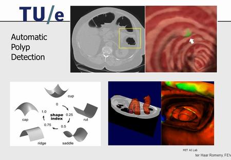 Ter Haar Romeny, FEV MIT AI Lab Automatic Polyp Detection.